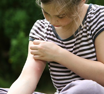 Co na ukąszenie komara?