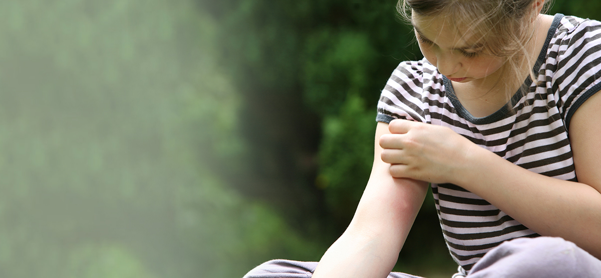 Co na ukąszenie komara?